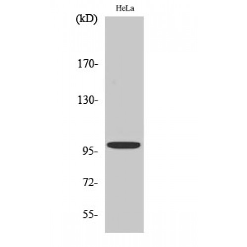 CTNNA1 / Catenin Alpha-1 Antibody - Western blot of Catenin-alpha E/N antibody