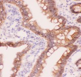 CTNNA1 / Catenin Alpha-1 Antibody - CTNNA1 antibody IHC-paraffin: Rat Intestine Tissue.