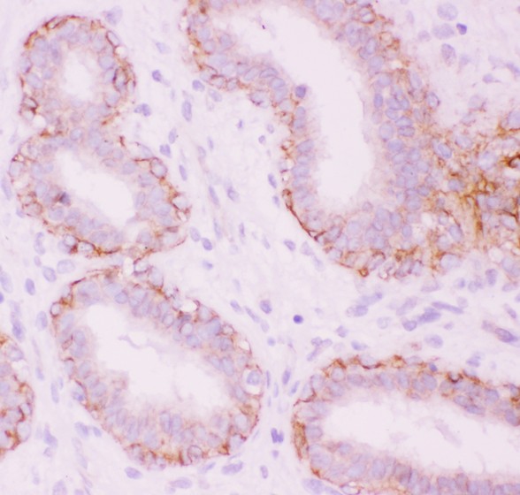 CTNNA1 / Catenin Alpha-1 Antibody - CTNNA1 antibody IHC-paraffin: Human Mammary Tissue.