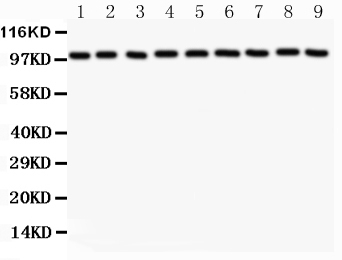CTNNA1 / Catenin Alpha-1 Antibody - Western blot analysis of CTNNA1 using anti-CTNNA1 antibody. Electrophoresis was performed on a 5-20% SDS-PAGE gel at 70V (Stacking gel) / 90V (Resolving gel) for 2-3 hours. The sample well of each lane was loaded with 50ug of sample under reducing conditions. Lane 1: Rat Liver Tissue Lysate Lane 2: Rat Lung Tissue Lysate Lane 3: Rat Cardiac Muscle Tissue Lysate Lane 4: NIH3T3 Whole Cell Lysate Lane 5: PC-12 Whole Cell Lysate Lane 6: HEPG2 Whole Cell Lysate Lane 7: HELA Whole Cell Lysate Lane 8: MCF-7 Whole Cell Lysate Lane 9: HEPA Whole Cell Lysate After Electrophoresis, proteins were transferred to a Nitrocellulose membrane at 150mA for 50-90 minutes. Blocked the membrane with 5% Non-fat Milk/ TBS for 1.5 hour at RT. The membrane was incubated with rabbit anti-CTNNA1 antigen affinity purified polyclonal antibody at 0.5 µg/mL overnight at 4°C, then washed with TBS-0.1% Tween 3 times with 5 minutes each and probed with a goat anti-rabbit IgG-HRP secondary antibody at a dilution of 1:10000 for 1.5 hour at RT. The signal is developed using an Enhanced Chemiluminescent detection (ECL) kit with Tanon 5200 system. A specific band was detected for CTNNA1 at approximately 100KD. The expected band size for CTNNA1 is at 100KD.