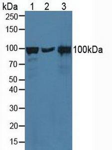 CTNNA1 / Catenin Alpha-1 Antibody - Western Blot; Sample: Lane1: Human Hela Cells; Lane2: Porcine Brain Tissue; Lane3: Human A431 Cells.