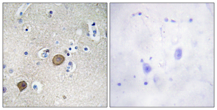 CTNNA1 / Catenin Alpha-1 Antibody - Immunohistochemistry analysis of paraffin-embedded human brain tissue, using Catenin-alpha1 Antibody. The picture on the right is blocked with the synthesized peptide.
