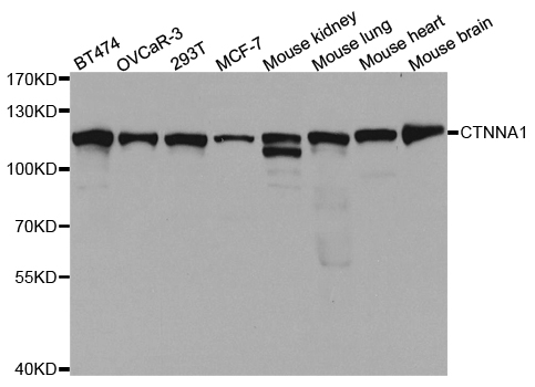 CTNNA1 / Catenin Alpha-1 Antibody - Western blot analysis of extracts of various cell lines.