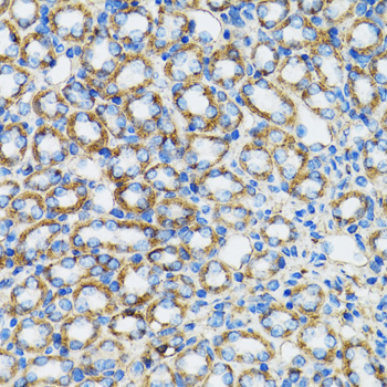 CTNNA1 / Catenin Alpha-1 Antibody - Immunohistochemistry of paraffin-embedded rat kidney tissue.