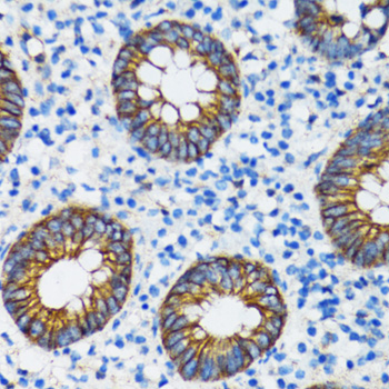 CTNNA1 / Catenin Alpha-1 Antibody - Immunohistochemistry of paraffin-embedded human vermiform appendix tissue.
