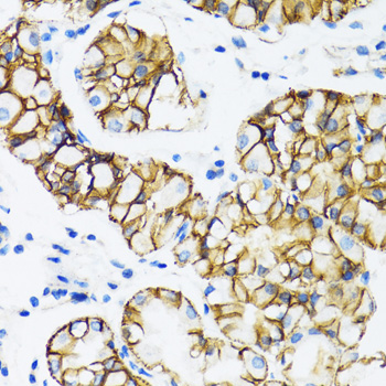 CTNNA1 / Catenin Alpha-1 Antibody - Immunohistochemistry of paraffin-embedded human stomach tissue.