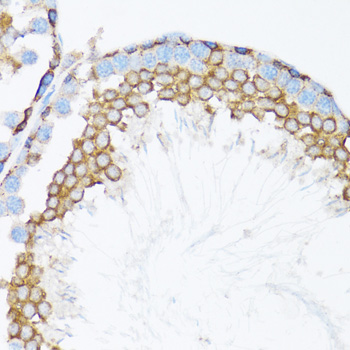 CTNNA1 / Catenin Alpha-1 Antibody - Immunohistochemistry of paraffin-embedded mouse testis tissue.