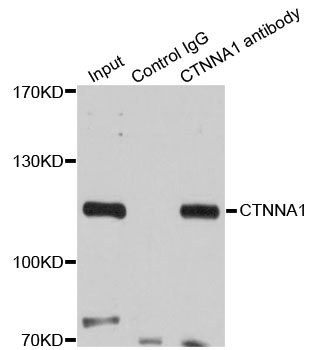 CTNNA1 / Catenin Alpha-1 Antibody - Immunoprecipitation analysis of 200ug extracts of 293T cells.