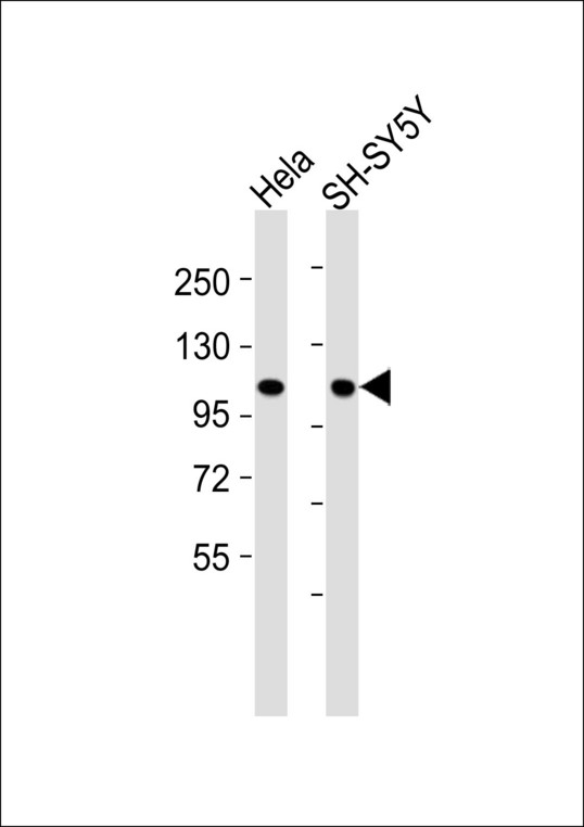 CTNNA1 / Catenin Alpha-1 Antibody - All lanes : Anti-Catenin alpha 1/2 Antibody at 1:1000 dilution Lane 1: HeLa whole cell lysates Lane 2: SH-SY5Y whole cell lysates Lysates/proteins at 20 ug per lane. Secondary Goat Anti-Rabbit IgG, (H+L),Peroxidase conjugated at 1/10000 dilution Predicted band size : 100 kDa Blocking/Dilution buffer: 5% NFDM/TBST.