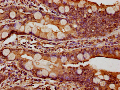 CTNNA1 / Catenin Alpha-1 Antibody - IHC image of CTNNA1 Antibody diluted at 1:1000 and staining in paraffin-embedded human small intestine tissue performed on a Leica BondTM system. After dewaxing and hydration, antigen retrieval was mediated by high pressure in a citrate buffer (pH 6.0). Section was blocked with 10% normal goat serum 30min at RT. Then primary antibody (1% BSA) was incubated at 4°C overnight. The primary is detected by a biotinylated secondary antibody and visualized using an HRP conjugated SP system.