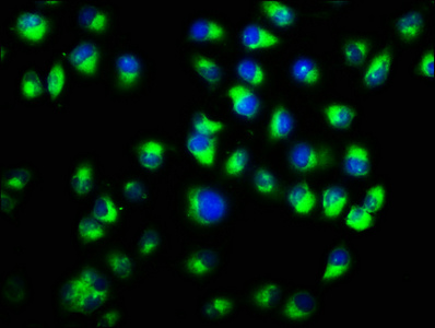 CTNNA1 / Catenin Alpha-1 Antibody - Immunofluorescence staining of Hela cells with CTNNA1 Antibody at 1:333, counter-stained with DAPI. The cells were fixed in 4% formaldehyde, permeabilized using 0.2% Triton X-100 and blocked in 10% normal Goat Serum. The cells were then incubated with the antibody overnight at 4°C. The secondary antibody was Alexa Fluor 488-congugated AffiniPure Goat Anti-Rabbit IgG(H+L).