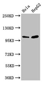 CTNNA1 / Catenin Alpha-1 Antibody - Western Blot Positive WB detected in: Hela whole cell lysate, HepG2 whole cell lysate All lanes: CTNNA1 antibody at 3.3µg/ml Secondary Goat polyclonal to rabbit IgG at 1/50000 dilution Predicted band size: 101 kDa Observed band size: 101 kDa