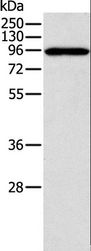 CTNNA1 / Catenin Alpha-1 Antibody - Western blot analysis of A431 cell, using CTNNA1 Polyclonal Antibody at dilution of 1:600.