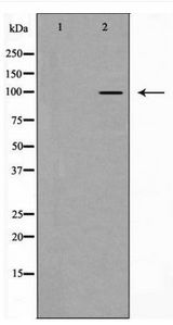 CTNNA1 / Catenin Alpha-1 Antibody - Western blot of Catenin alpha 1 expression in HeLa cell lysate