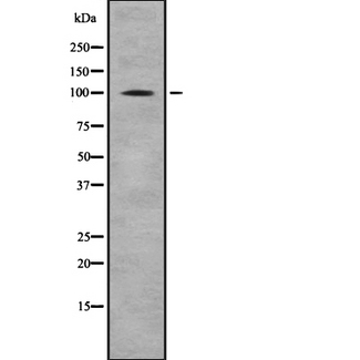 CTNNA1 / Catenin Alpha-1 Antibody - Western blot analysis of CTNNA1/CTNNA2 using HeLa whole cells lysates