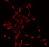 CTNNA1 / Catenin Alpha-1 Antibody - Staining HeLa cells by IF/ICC. The samples were fixed with PFA and permeabilized in 0.1% Triton X-100, then blocked in 10% serum for 45 min at 25°C. The primary antibody was diluted at 1:200 and incubated with the sample for 1 hour at 37°C. An Alexa Fluor 594 conjugated goat anti-rabbit IgG (H+L) Ab, diluted at 1/600, was used as the secondary antibody.
