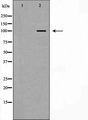 CTNNA1 / Catenin Alpha-1 Antibody - Western blot analysis of HeLa whole cells lysates using CTNNA1 antibody. The lane on the left is treated with the antigen-specific peptide.