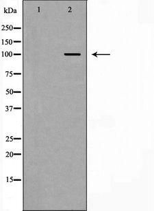 CTNNA1 / Catenin Alpha-1 Antibody - Western blot analysis of HeLa whole cells lysates using CTNNA1 antibody. The lane on the left is treated with the antigen-specific peptide.