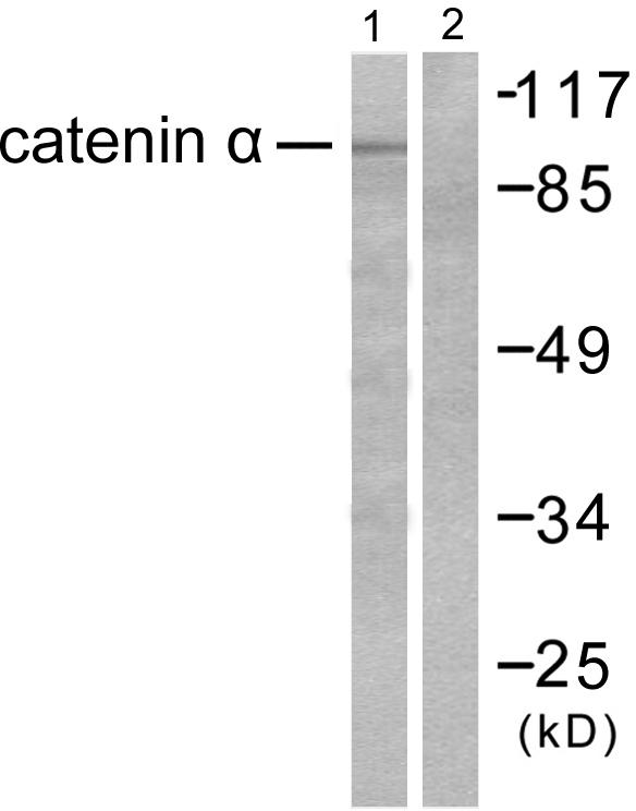 CTNNA1 / Catenin Alpha-1 Antibody - Western blot analysis of extracts from HeLa cells, using Catenin-a antibody.