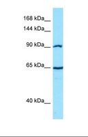 CTNNA2 / Alpha-2 Catenin Antibody - Western blot of Human PANC1. CTNNA2 antibody dilution 1.0 ug/ml.  This image was taken for the unconjugated form of this product. Other forms have not been tested.