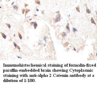 CTNNA2 / Alpha-2 Catenin Antibody