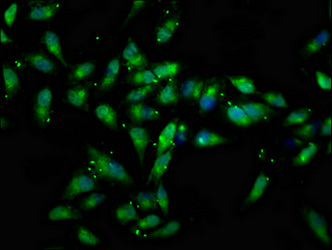 CTNNA2 / Alpha-2 Catenin Antibody - Immunofluorescence staining of Hela cells at a dilution of 1:133, counter-stained with DAPI. The cells were fixed in 4% formaldehyde, permeabilized using 0.2% Triton X-100 and blocked in 10% normal Goat Serum. The cells were then incubated with the antibody overnight at 4 °C.The secondary antibody was Alexa Fluor 488-congugated AffiniPure Goat Anti-Rabbit IgG (H+L) .
