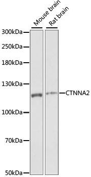 CTNNA2 / Alpha-2 Catenin Antibody - Western blot analysis of extracts of various cell lines, using CTNNA2 antibody at 1:1000 dilution. The secondary antibody used was an HRP Goat Anti-Rabbit IgG (H+L) at 1:10000 dilution. Lysates were loaded 25ug per lane and 3% nonfat dry milk in TBST was used for blocking. An ECL Kit was used for detection and the exposure time was 1S.