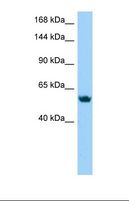 CTNNA3 / Alpha-3 Catenin Antibody - Western blot of Jurkat. BMP8B antibody dilution 1.0 ug/ml.  This image was taken for the unconjugated form of this product. Other forms have not been tested.