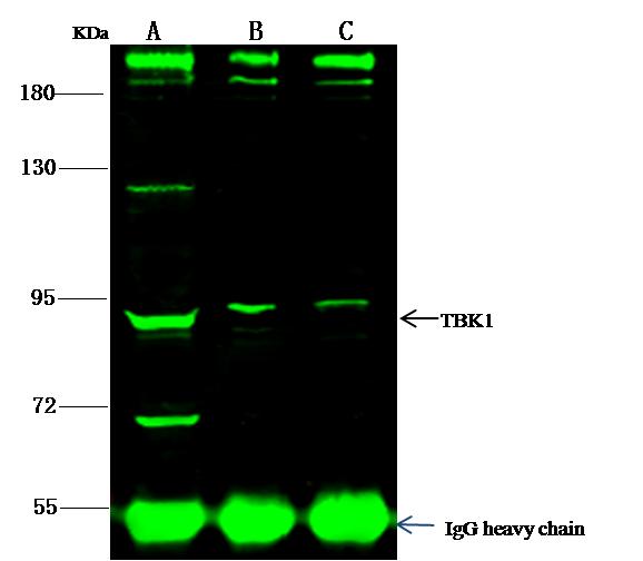 CTNNA3 / Alpha-3 Catenin Antibody - TBK1 was immunoprecipitated using: Lane A: 0.5 mg 293T Whole Cell Lysate. Lane B: 0.5 mg Jurkat Whole Cell Lysate. Lane C:0.5 mg Hela Whole Cell Lysate. 1 uL anti-TBK1 rabbit polyclonal antibody and 15 ul of 50% Protein G agarose. Primary antibody: Anti-TBK1 rabbit polyclonal antibody, at 1:500 dilution. Secondary antibody: Dylight 800-labeled antibody to rabbit IgG (H+L), at 1:5000 dilution. Developed using the odssey technique. Performed under reducing conditions. Predicted band size: 88 kDa. Observed band size: 88 kDa.