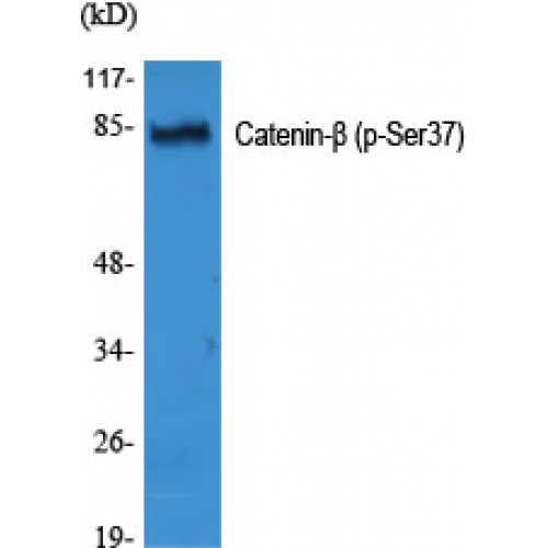 CTNNB1 / Beta Catenin Antibody - Western blot of Phospho-Catenin-beta (S37) antibody