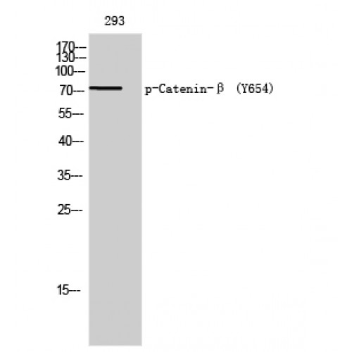 CTNNB1 / Beta Catenin Antibody - Western blot of Phospho-Catenin-beta (Y654) antibody