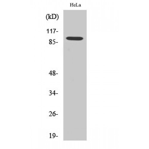 CTNNB1 / Beta Catenin Antibody - Western blot of Catenin-beta1 antibody