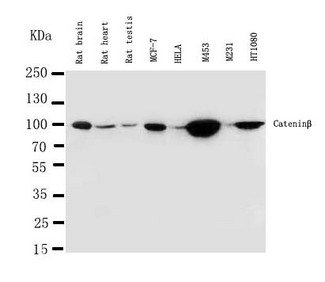 CTNNB1 / Beta Catenin Antibody - beta Catenin antibody Western blot. Lane 1: Rat Brain Tissue Lysate. Lane 2: Rat Heart Tissue Lysate. Lane 3: Rat Testis Tissue Lysate. Lane 4: MCF-7 Cell Lysate. Lane 5: HELA Cell Lysate. Lane 6: M453 Cell Lysate. Lane 7: M231 Cell Lysate. Lane 8: HT1080 Cell Lysate.