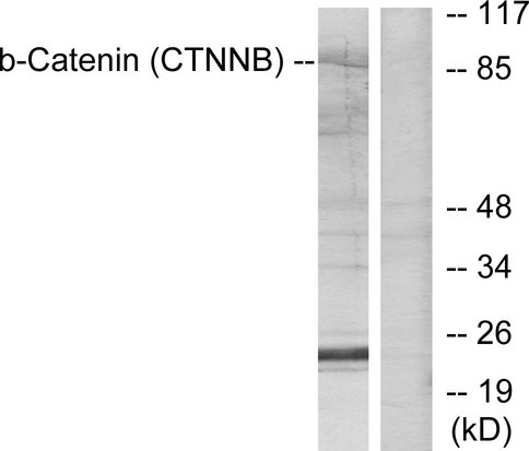 CTNNB1 / Beta Catenin Antibody - Western blot analysis of lysates from SW626 cells, using Catenin-beta Antibody. The lane on the right is blocked with the synthesized peptide.