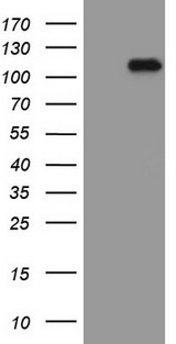 CTNNB1 / Beta Catenin Antibody - HEK293T cells were transfected with the pCMV6-ENTRY control (Left lane) or pCMV6-ENTRY CTNNB1 (Right lane) cDNA for 48 hrs and lysed. Equivalent amounts of cell lysates (5 ug per lane) were separated by SDS-PAGE and immunoblotted with anti-CTNNB1 (1:2000).