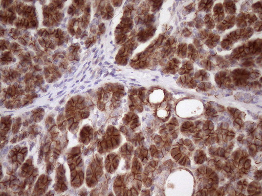 CTNNB1 / Beta Catenin Antibody - IHC of paraffin-embedded Human pancreas tissue using anti-CTNNB1 mouse monoclonal antibody. (Heat-induced epitope retrieval by Tris-EDTA, pH8.0)(1:150).