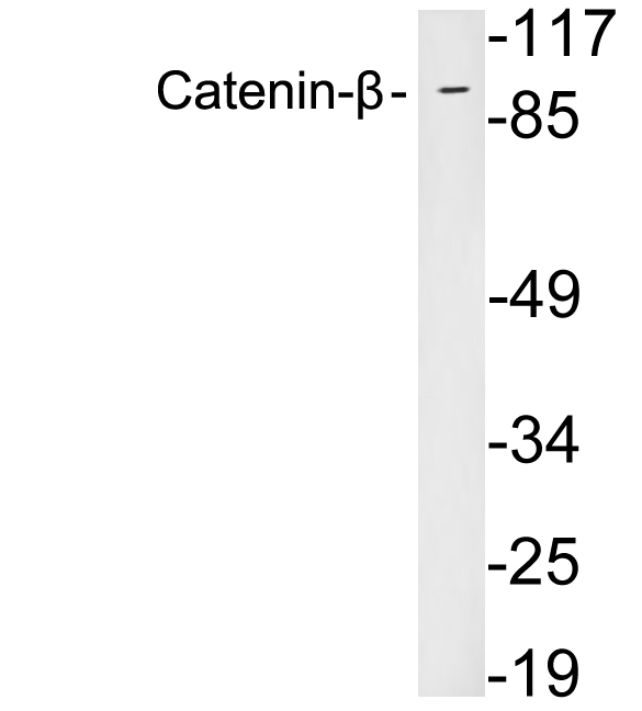 CTNNB1 / Beta Catenin Antibody - Western blot analysis of lysates from HeLa cells, using Catenin-Î² antibody.