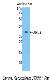 CTNNB1 / Beta Catenin Antibody - Western blot of recombinant CTNNB1 / Beta Catenin.  This image was taken for the unconjugated form of this product. Other forms have not been tested.