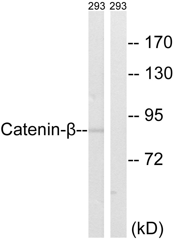 CTNNB1 / Beta Catenin Antibody - Western blot analysis of lysates from 293 cells, using Catenin-beta Antibody. The lane on the right is blocked with the synthesized peptide.
