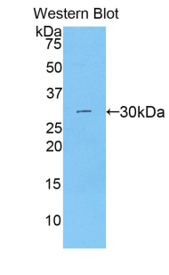 CTNNB1 / Beta Catenin Antibody - Western blot of recombinant CTNNB1 / Beta Catenin.  This image was taken for the unconjugated form of this product. Other forms have not been tested.