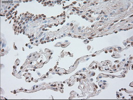 CTNNB1 / Beta Catenin Antibody - IHC of paraffin-embedded Human lung tissue using anti-CTNNB1 mouse monoclonal antibody.