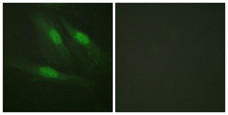 CTNNB1 / Beta Catenin Antibody - Immunofluorescence analysis of HeLa cells, using Catenin-beta Antibody. The picture on the right is blocked with the synthesized peptide.