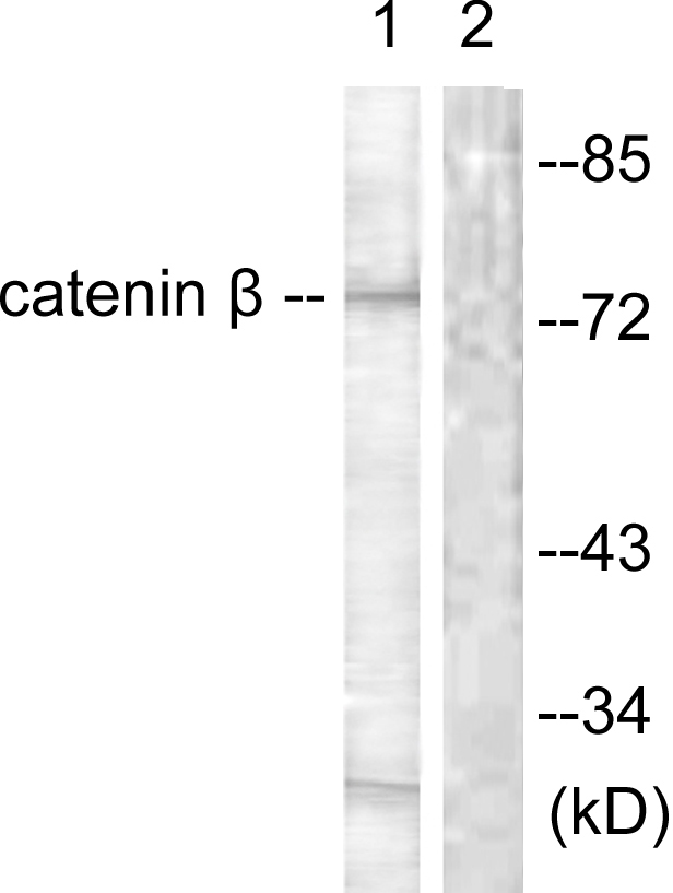 CTNNB1 / Beta Catenin Antibody - Western blot analysis of lysates from rat brain cells, using Catenin-beta Antibody. The lane on the right is blocked with the synthesized peptide.