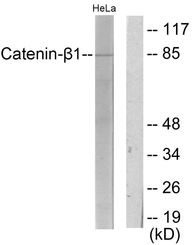 CTNNB1 / Beta Catenin Antibody - Western blot analysis of lysates from HeLa cells, using Catenin-beta1 Antibody. The lane on the right is blocked with the synthesized peptide.