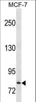 CTNNB1 / Beta Catenin Antibody - CTNNB1 Antibody western blot of MCF-7 cell line lysates (35 ug/lane). The CTNNB1 antibody detected the CTNNB1 protein (arrow).