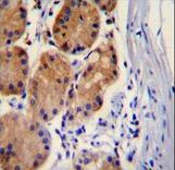 CTNNB1 / Beta Catenin Antibody - CTNB1 Antibody immunohistochemistry of formalin-fixed and paraffin-embedded human stomach tissue followed by peroxidase-conjugated secondary antibody and DAB staining.
