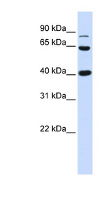 CTNNB1 / Beta Catenin Antibody - CTNNB1 / Beta Catenin antibody Western blot of Fetal Heart lysate. This image was taken for the unconjugated form of this product. Other forms have not been tested.