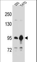CTNNB1 / Beta Catenin Antibody - CTNNB1 Antibody western blot of 293,T47D cell line lysates (35 ug/lane). The CTNNB1 antibody detected the CTNNB1 protein (arrow).