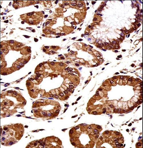 CTNNB1 / Beta Catenin Antibody - CTNNB1 Antibody immunohistochemistry of formalin-fixed and paraffin-embedded human stomach tissue followed by peroxidase-conjugated secondary antibody and DAB staining.