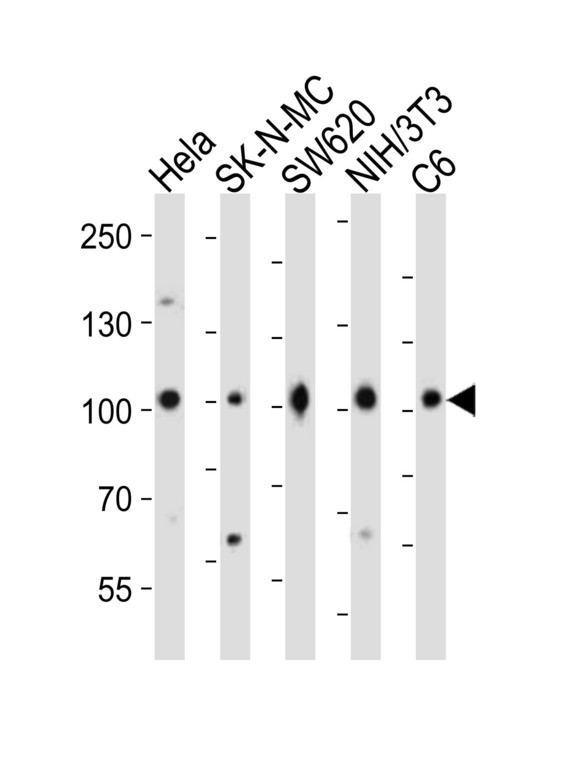 CTNNB1 / Beta Catenin Antibody - Western blot of lysates from HeLa, SK-N-MC, SW620, mouse NIH/3T3, rat C6 cell line (from left to right) with CTNNB1 Antibody. Antibody was diluted at 1:1000 at each lane. A goat anti-rabbit IgG H&L (HRP) at 1:10000 dilution was used as the secondary antibody. Lysates at 20 ug per lane.